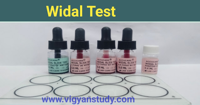 widal test kya hota hai | kese aur kyu kiya jata hai