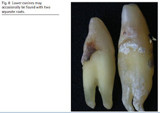 Fig. 8  Lower canines may occasionally be found with two separate roots.