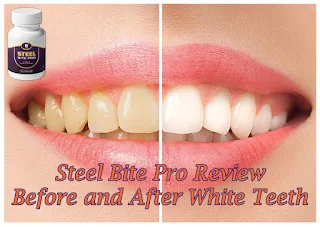 Steel Bite Pro Review 2021