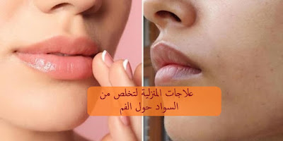 علاجات المنزلية لتخلص من السواد حول الفم