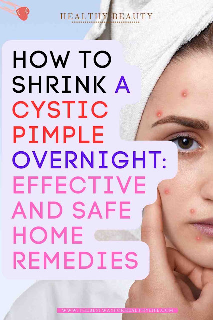 images how to shrink a cystic pimple overnight