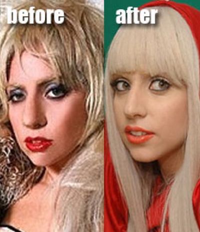 pictures of lady gaga before plastic surgery. Gaga#39;s Plastic Surgery,