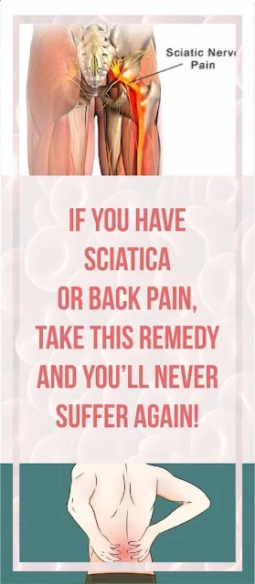 If You Have Sciatica Or Back Pain, Take This Remedy And You’Ll Never Suffer Again!