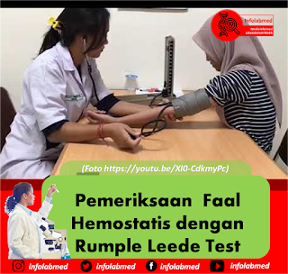 Pemeriksaan  Faal  Hemostatis dengan Rumple Leede Test