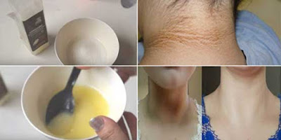 Remove Dirt and Darkness From Your Neck In Just 20 Minutes