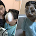 Akibat terlalu kerap bermain handphone, budak terpaksa jalani pembedahan kerana matanya tidak berfungsi secara serentak