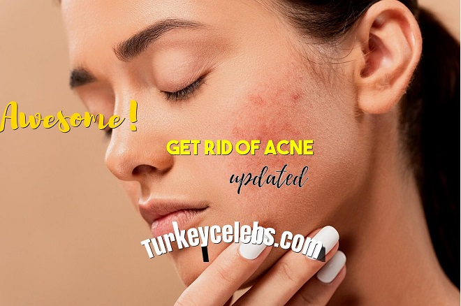 get rid of acne scars,get rid of acne,get rid of acne fast,get rid of acne redness,get rid of acne at home,get rid of acne and dark spots,get rid of acne asap,get rid of acne blemishes,get rid of acne cyst