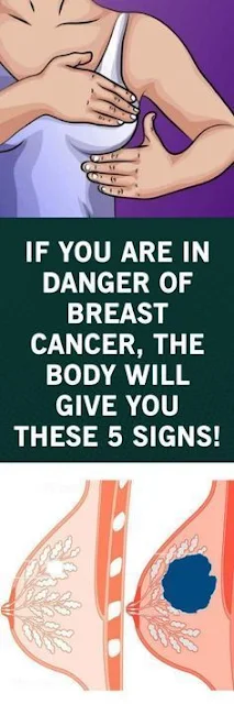 If You Are In Danger Of Breast Cancer, The Body Will Give You These 5 Signs!