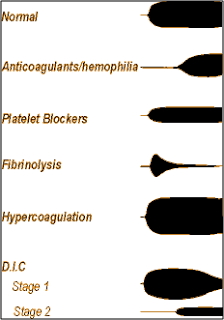 Viscoelastic Measures of Coagulation