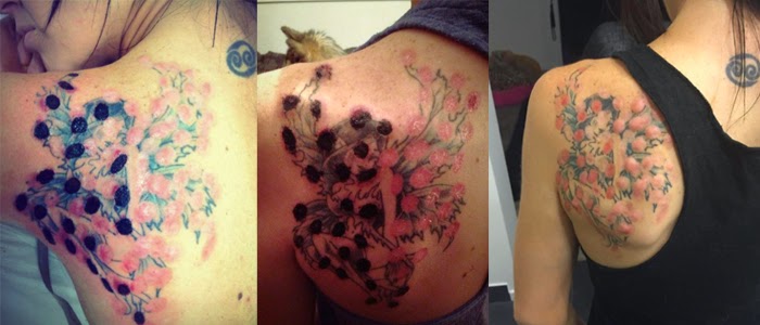 Acid tattoo removal is NOT an option and should never be considered ...