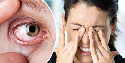 Symptoms of dry eye, Causes of dry eye syndrome