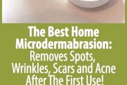 The Best Home Microdermabrasion: Removes Spots, Wrinkles, Scars and Acne After The First Use!