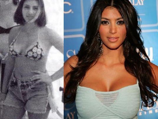 kim kardashian plastic surgery before and after. Kim Kardashian breast implants