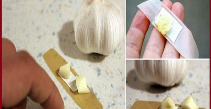 Put a Clove of Garlic On Your Skin and See What Will Happen ... The results Will Surprise You!