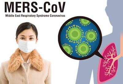 Middle East Respiratory Syndrome-Corona Virus atau biasa disingkat MERS-CoV adalah penyakit sindrom pernapasan yang disebabkan oleh Virus-Corona yang menyerang saluran pernapasan mulai dari yang ringan sampai yang berat. Gejalanya adalah demam, batuk dan sesak nafas, bersifat akut, dan biasanya pasien memiliki penyakit ko-morbid (penyakit penyerta). Virus MERS-CoV