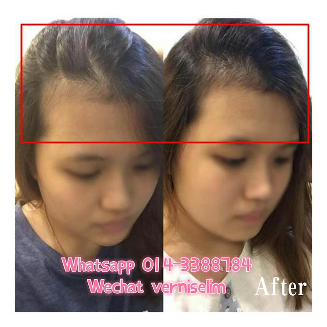 yang ze tang: before after
