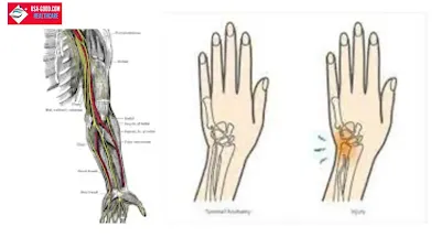 What is Ulnar wrist pain ?