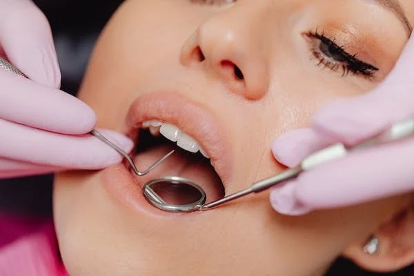 Delta Dental Insurance policies and details