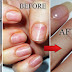 How To Grow Natural Nails After Damage From Acrylics Or Gels!