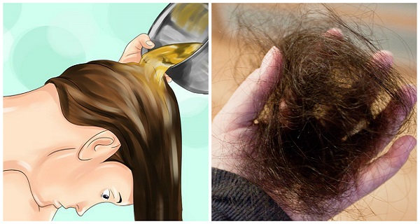 HOW TO FINALLY STOP HAIR LOSS? GROW BACK YOUR HAIR NATURALLY