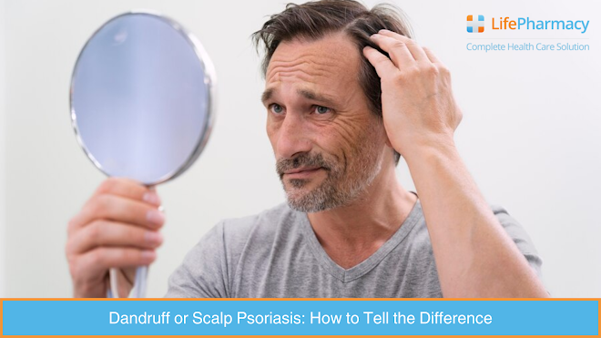 Dandruff or Scalp Psoriasis: How to Tell the Difference