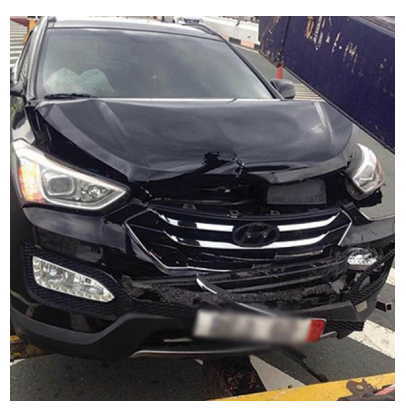 The truth behind Alden Richards' "Fake car accident" was REVEALED! 