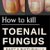 How to Get Rid of Toenail Fungus Fast and Naturally