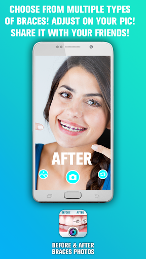 The best free android app - Dental Braces Before And After