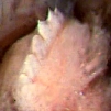 Tyrannobdella