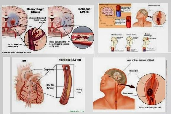 Bệnh mạch máu có thể là do biểu hiện của đau chân