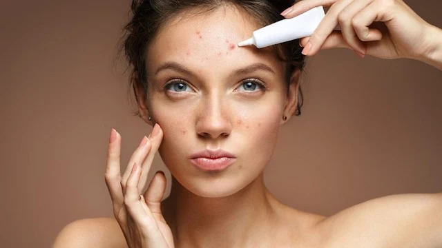 How Do You Get Rid of Forehead Blisters?