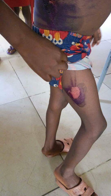 Photos: Man arrested in Abuja for burning 7-year-old son with hot pressing iron over food