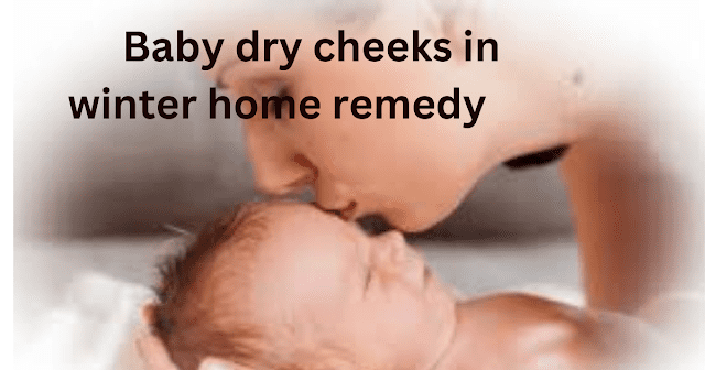 Baby-dry-cheeks-in-winter-home-remedy