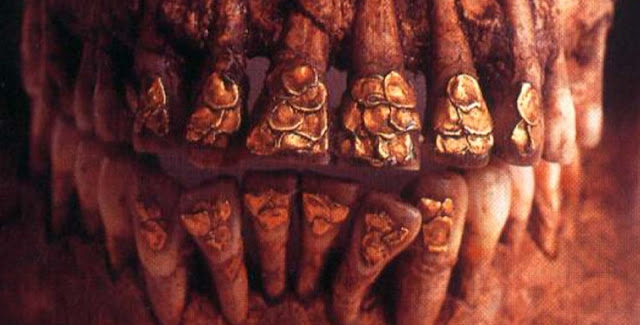 Инкрустированные золотом зубы черепа Болинао