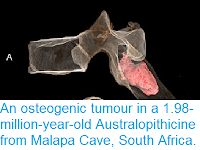 https://sciencythoughts.blogspot.com/2016/09/an-osteogenic-tumour-in-198-million.html