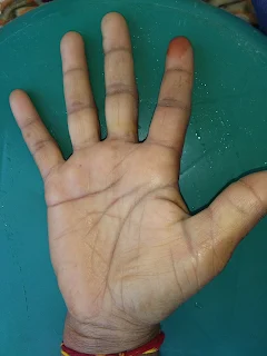 Rare Type Of Head Line On Hand Palmistry