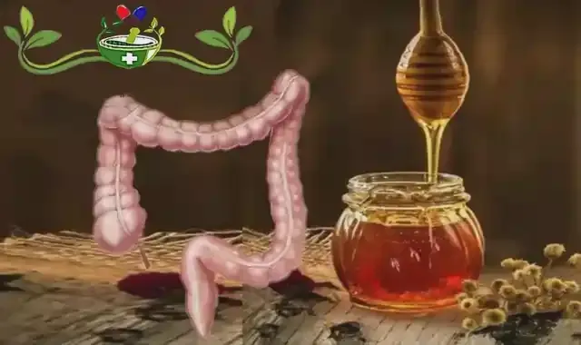 علاج بومزوي بالعسل الحر رفقة 5 أعشاب قوية