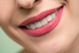 Close-up of a woman's white teeth