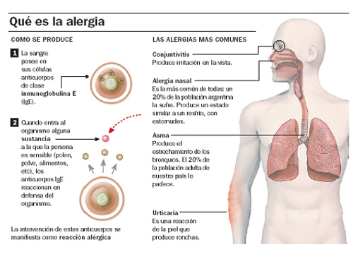 Síntomas más comunes de la alergia primaveral: rinitis, urticaria, conjuntivitis, etc