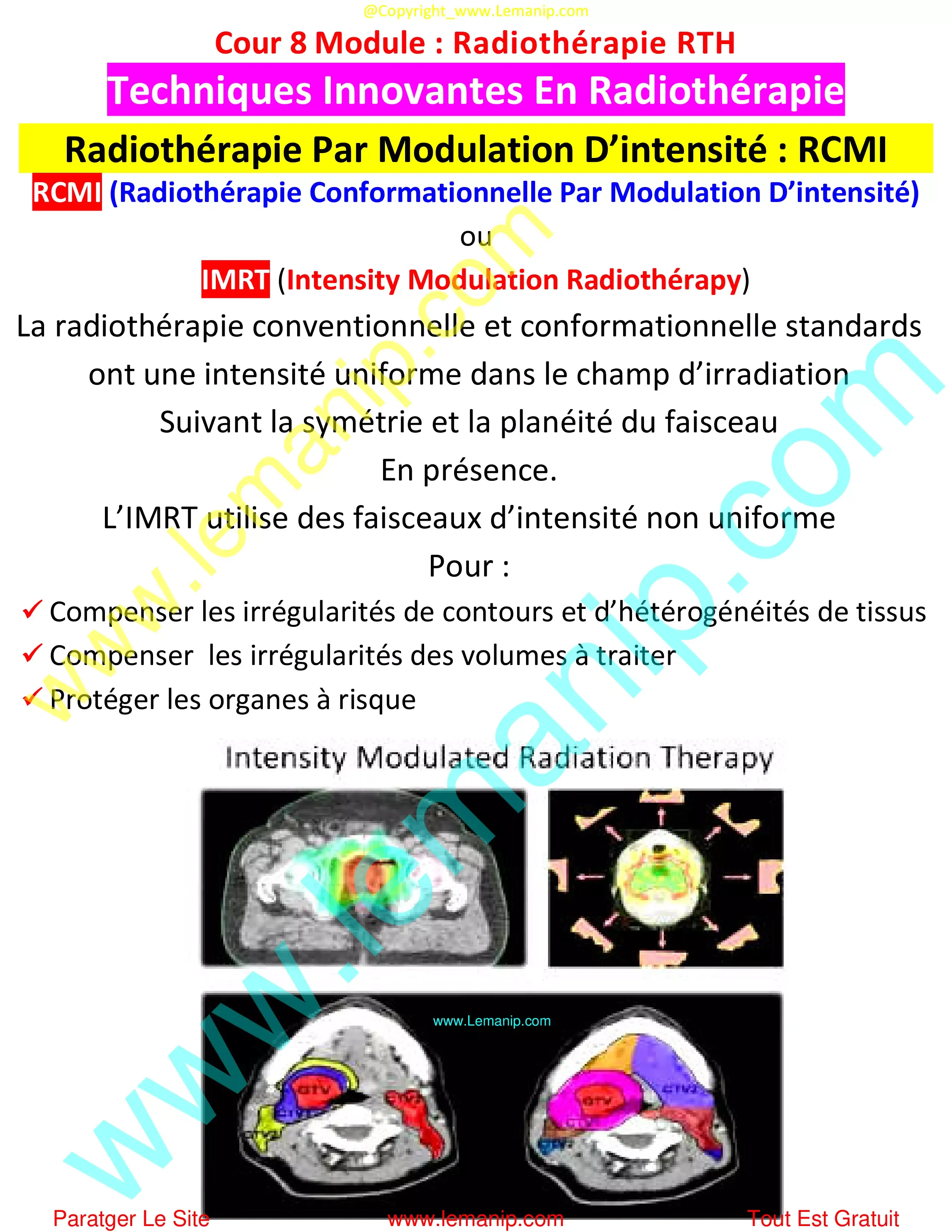 Radiothérapie Par Modulation D’intensité : RCMI
