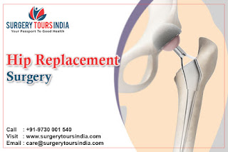 Hip Replacement Surgery in India