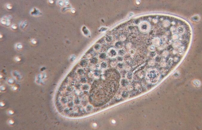 Pengertian Protozoa  protista mirip hewan  Klasifikasi 