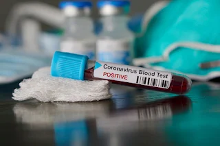 WHO Official, Two Others Tested Positive For Coronavirus In Bauchi State