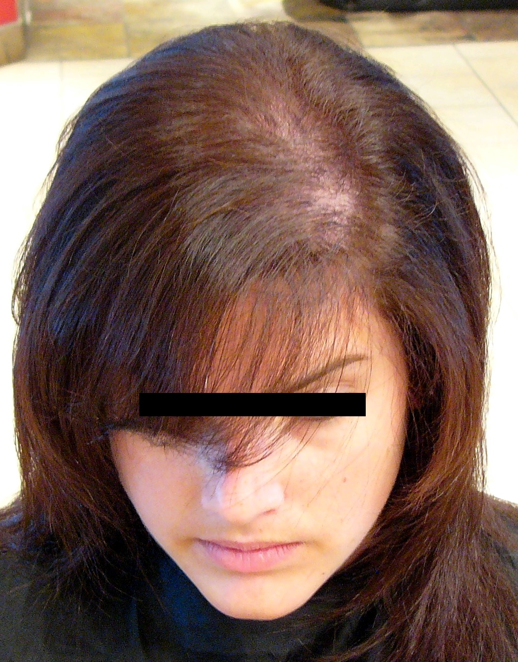 La Gazette Beauté: Taboo: cheveux fins et/ou clairsemés 
