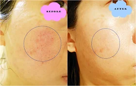 Pyunkang Yul 3 Step Mask Pack Pyunkang Yul 3 Step Mask Pack