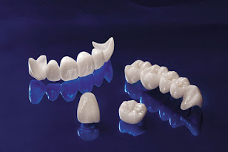 Các phương pháp điều trị răng hô