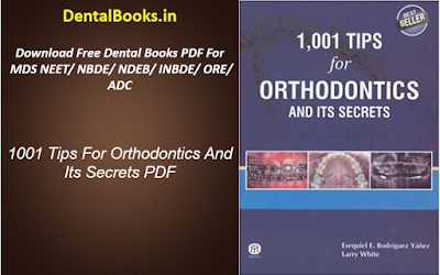 1001 Tips For Orthodontics And Its Secrets PDF