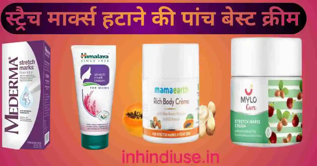  स्ट्रैच मार्क्स हटाने की पांच बेस्ट क्रीम(stretch marks hatane ki panch best cream)