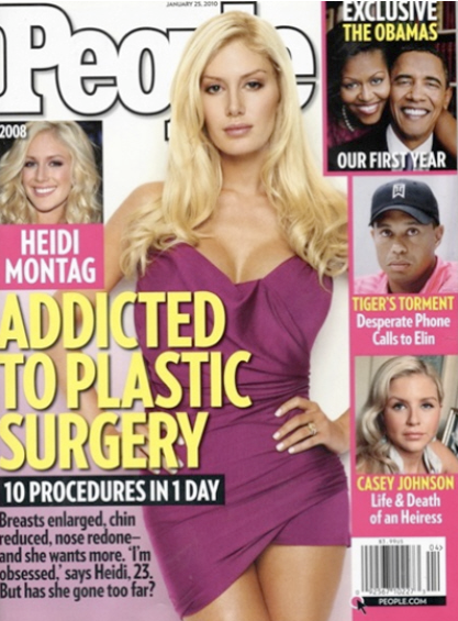 heidi montag before and after plastic surgery interview. heidi montag before and after