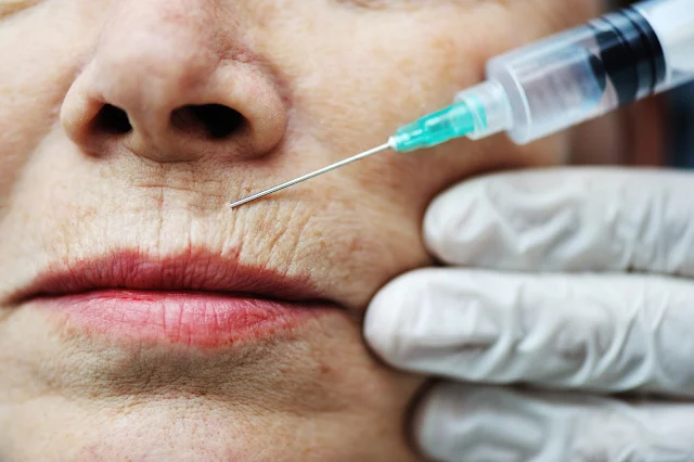 Say Goodbye to Wrinkles with Botox Treatment